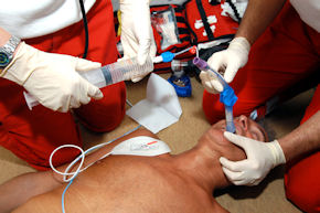 5. Mittels Farbcodierung ist das erforderliche Füllvolumen für den Cuff einfach zu applizieren. Hierbei verlagert sich der Tubus nochmals leicht.