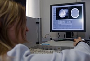 Mobile Stroke Unit: CT Diagnostik vor der Haustür.